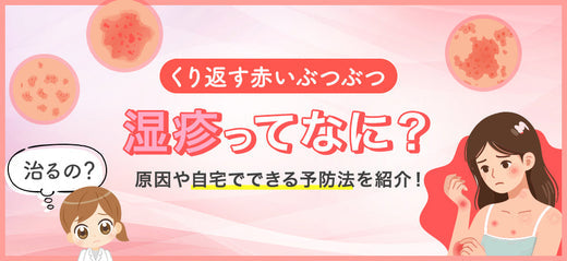 湿疹(皮膚炎)とは?赤いブツブツの原因や種類・対処法まで紹介