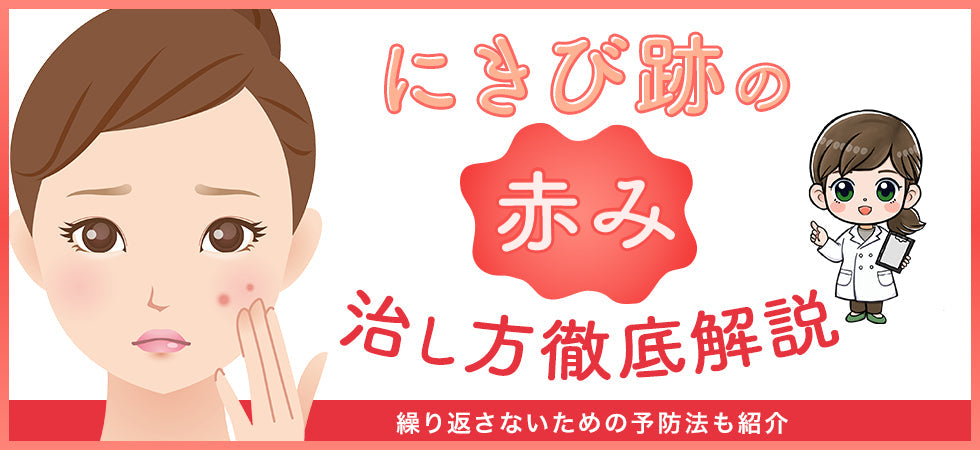 にきび跡の赤みを治す4つの方法！繰り返さないための予防法も紹介