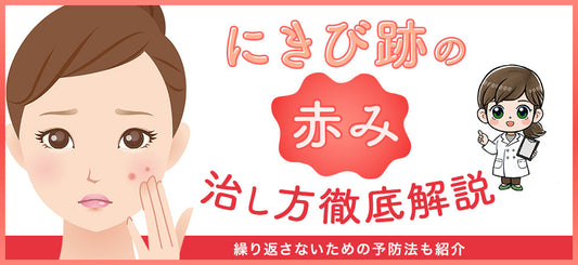 にきび跡の赤みを治す4つの方法！繰り返さないための予防法も紹介