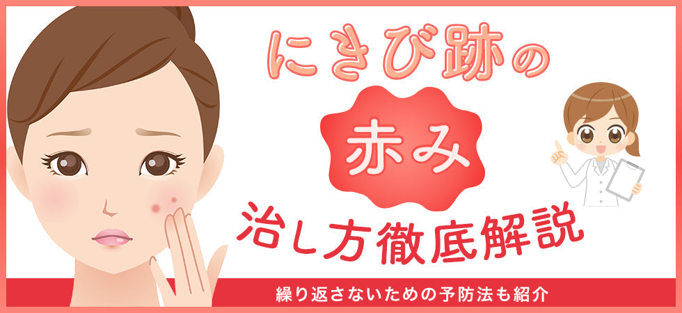 にきび跡の赤みを治す4つの方法！繰り返さないための予防法も紹介