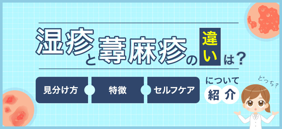 湿疹と蕁麻疹の違いとは？見分け方とそれぞれの対処法を紹介