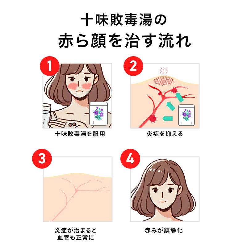 【3袋セット】くり返す赤ら顔に【漢方】十味敗毒湯錠 （医薬品）